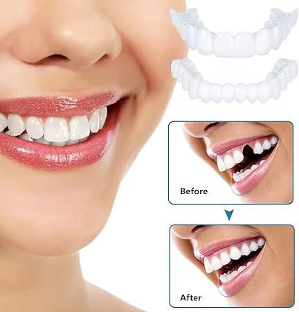 2 Pairs Instant Veneers Dentures Fake Teeth Braces Whitening Cosmetic Tooth Covering Snap on Smile Teeth Top and Bottom Clip in Veneers Temporary Upper and Lower False Teeth for Men and Women